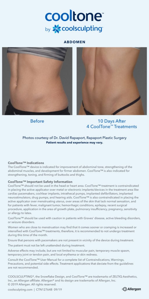 cooltone abdomen fat removal informational sheet